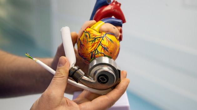 Стаття В Александровской больнице Киева впервые провели операцию по имплантации механического сердца Ранкове місто. Київ